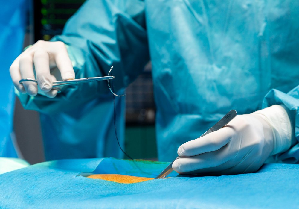 Cartilage Transplantation: What You Need to Know